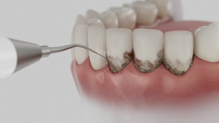 Reliable Teeth Cleaning And Checkup contractor in Howard County County, MO by Dentist Open Now